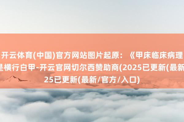 开云体育(中国)官方网站图片起原：《甲床临床病理图谱》第二是横行白甲-开云官网切尔西赞助商(2025已更新(最新/官方/入口)